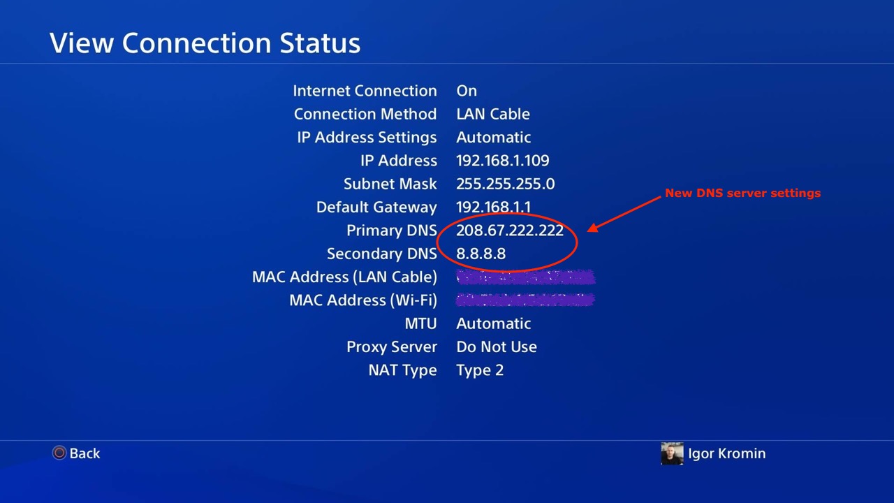 ps4 network dns settings